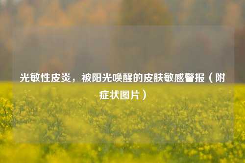 光敏性皮炎，被阳光唤醒的皮肤敏感警报（附症状图片）